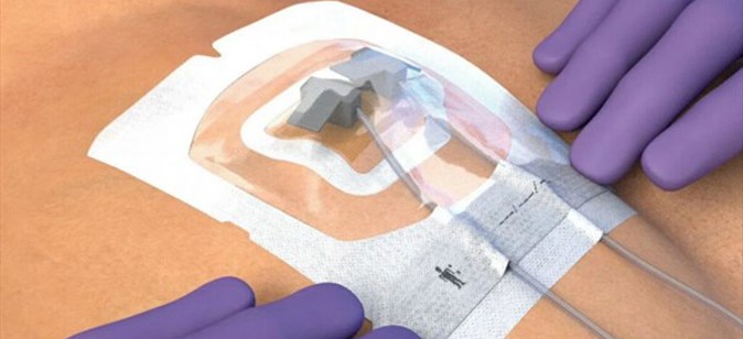 3M™ TEGADERM™ – VIŠE OD OBIČNOG FLASTERA