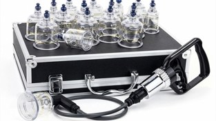 CUPPING - terapija za liječenje brojnih tegoba