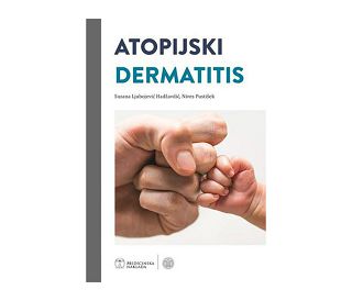 ATOPIJSKI DERMATITIS, Suzana Ljubojević Hadžavdić, Nives Pustišek