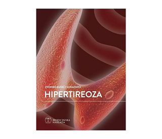 HIPERTIREOZA, Zvonko Kusić