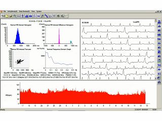 holter-ekg-a-tlc-5000-pc-program--35130_7.jpg