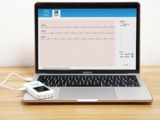 kucni-ekg-uredaj-pm10-33246_3.jpg