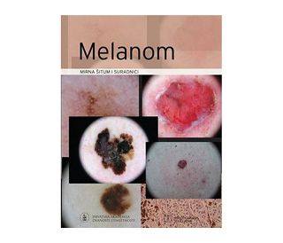 MELANOM, Mirna Šitum