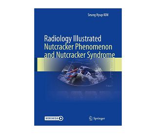 RADIOLOGY ILLUSTRATED: NUTCRACKER PHENOMENON AND NUTCRACKER SYNDROME, Seung Hyup Kim