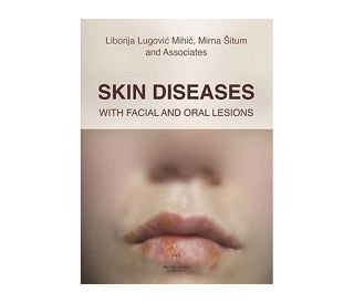 SKIN DISEASES, Liborija Lugović Mihić, Mirna Šitum