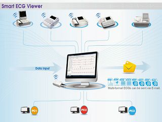 SOFTWARE ZA VE-300 VETERINARSKI EKG