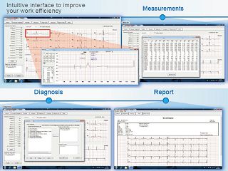 software-za-ve-300-veterinarski-ekg-33336_2.jpg