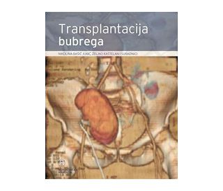 TRANSPLANTACIJA BUBREGA, Nikolina Bašić Jukić, Željko Kaštelan