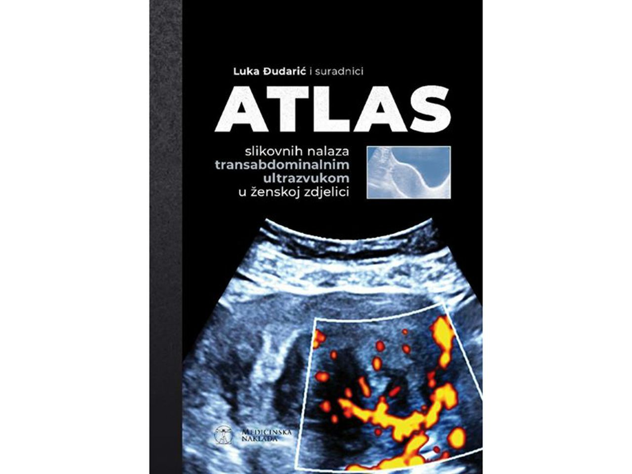 ATLAS SLIKOVNIH NALAZA TRANSABDOMINALNIM ULTRAZVUKOM U ŽENSKOJ ZDJELICI, Luka Đudarić
