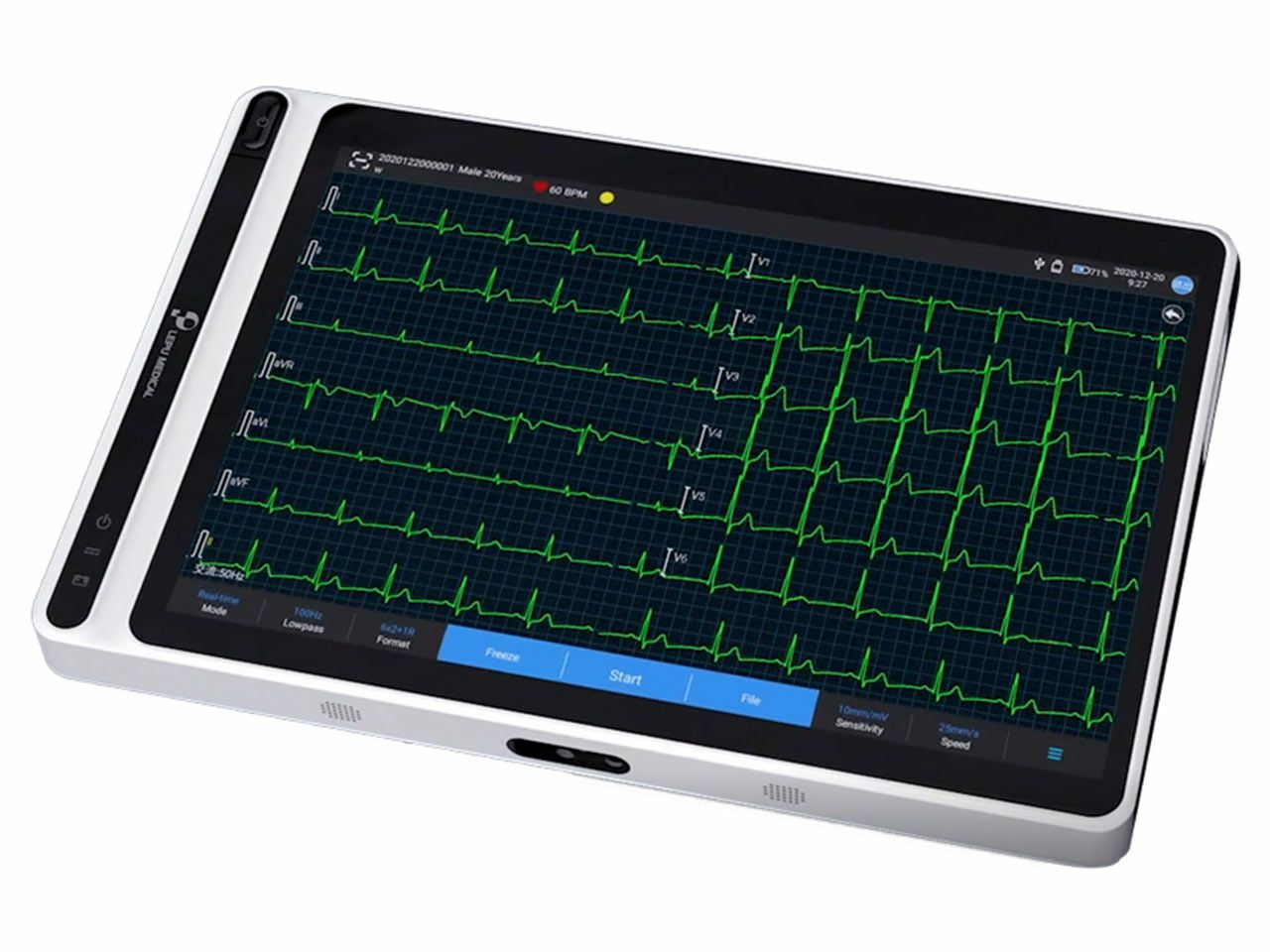 EKG TABLET NEO ECG S120