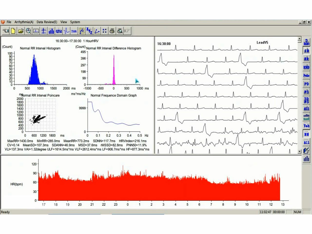 HOLTER EKG-A TLC 5000 + PC PROGRAM 