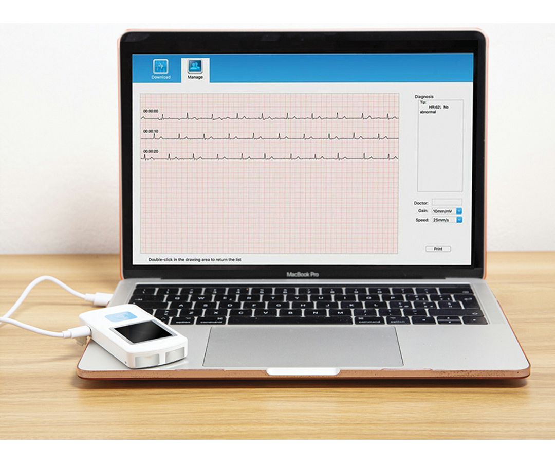 KUĆNI EKG UREĐAJ PM10