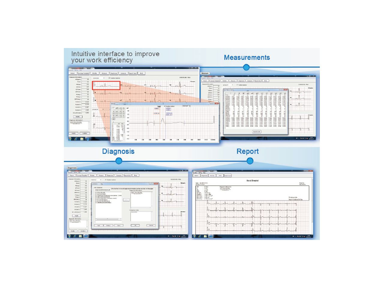 SOFTWARE ZA VE-300 VETERINARSKI EKG