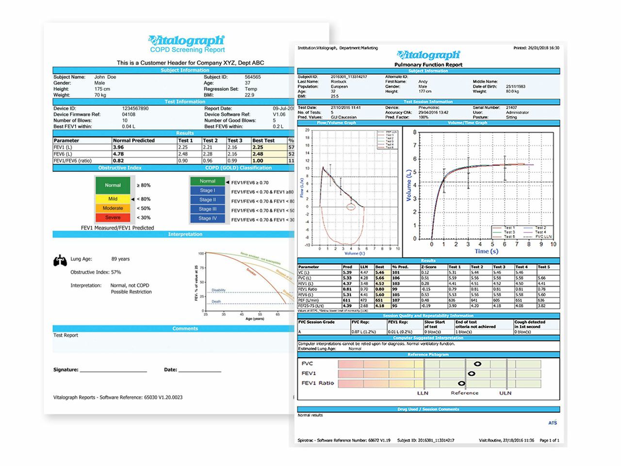 SPIROMETAR VITALOGRAF MICRO 63300