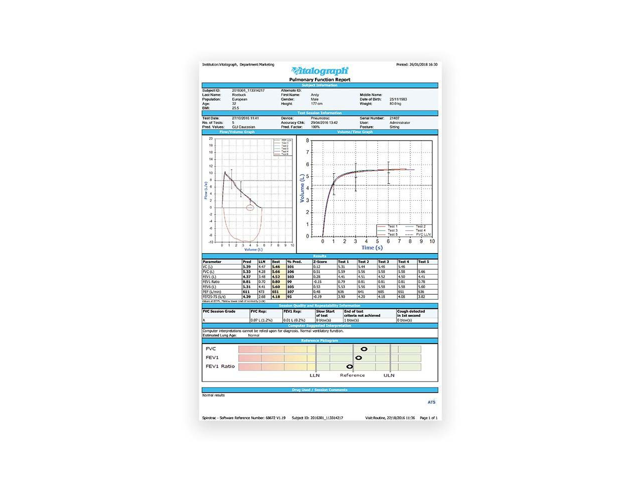 SPIROMETAR VITALOGRAF MICRO 63300